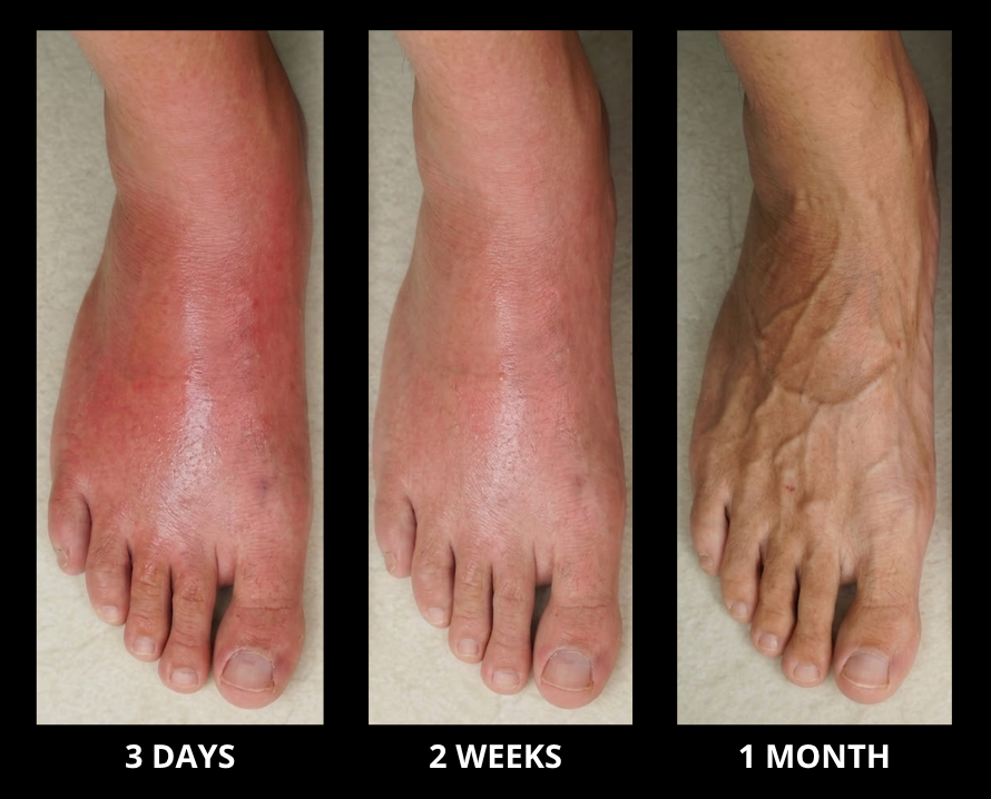 Before and After - 3 Days